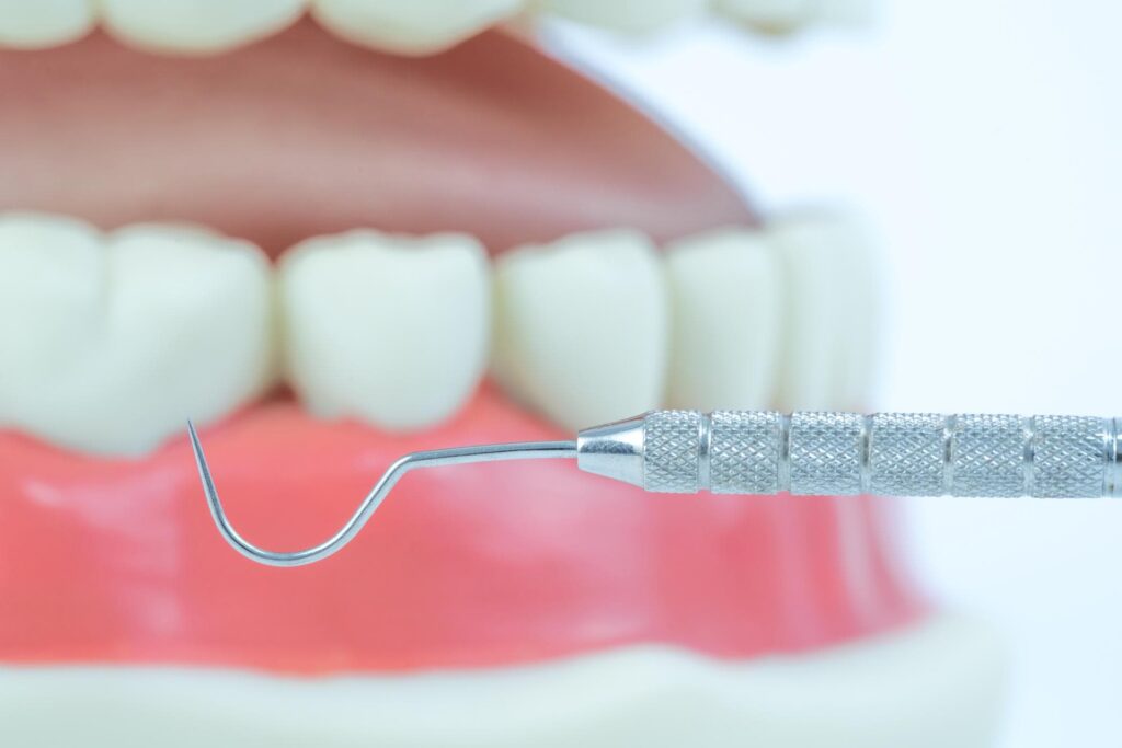 Periodoncia en Salamanca